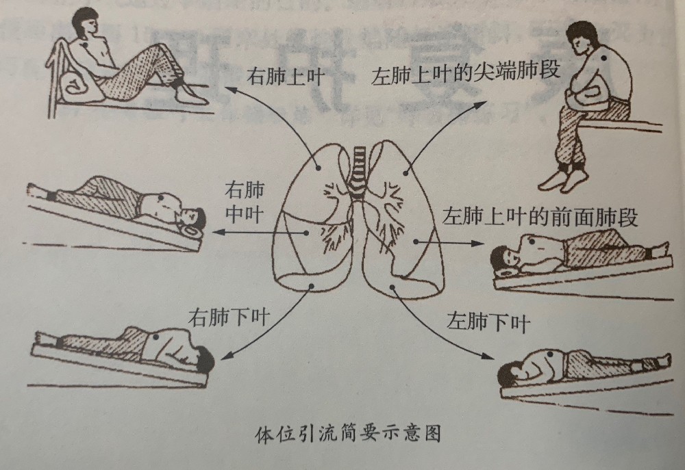 护士执业资格考试常见问题答疑，心肌梗死患者行溶栓疗法